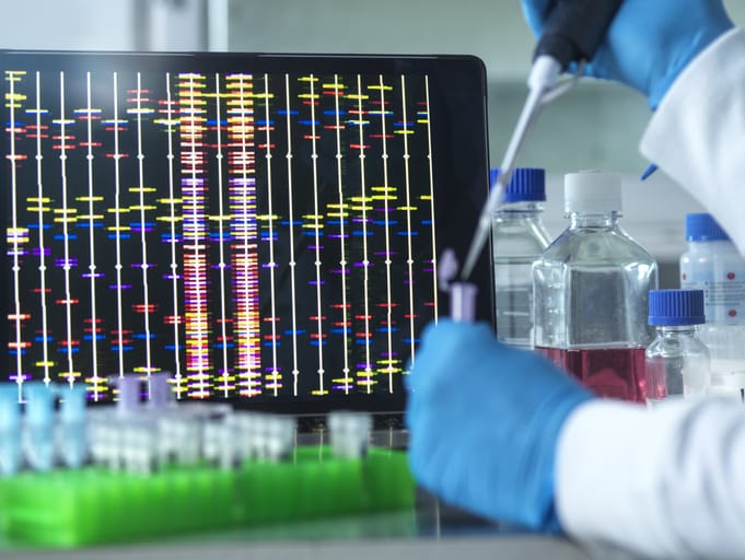 Scientist extracting DNA (deoxyribonucleic acid) sample from a vial ready for automated analysis with a DNA profile on screen