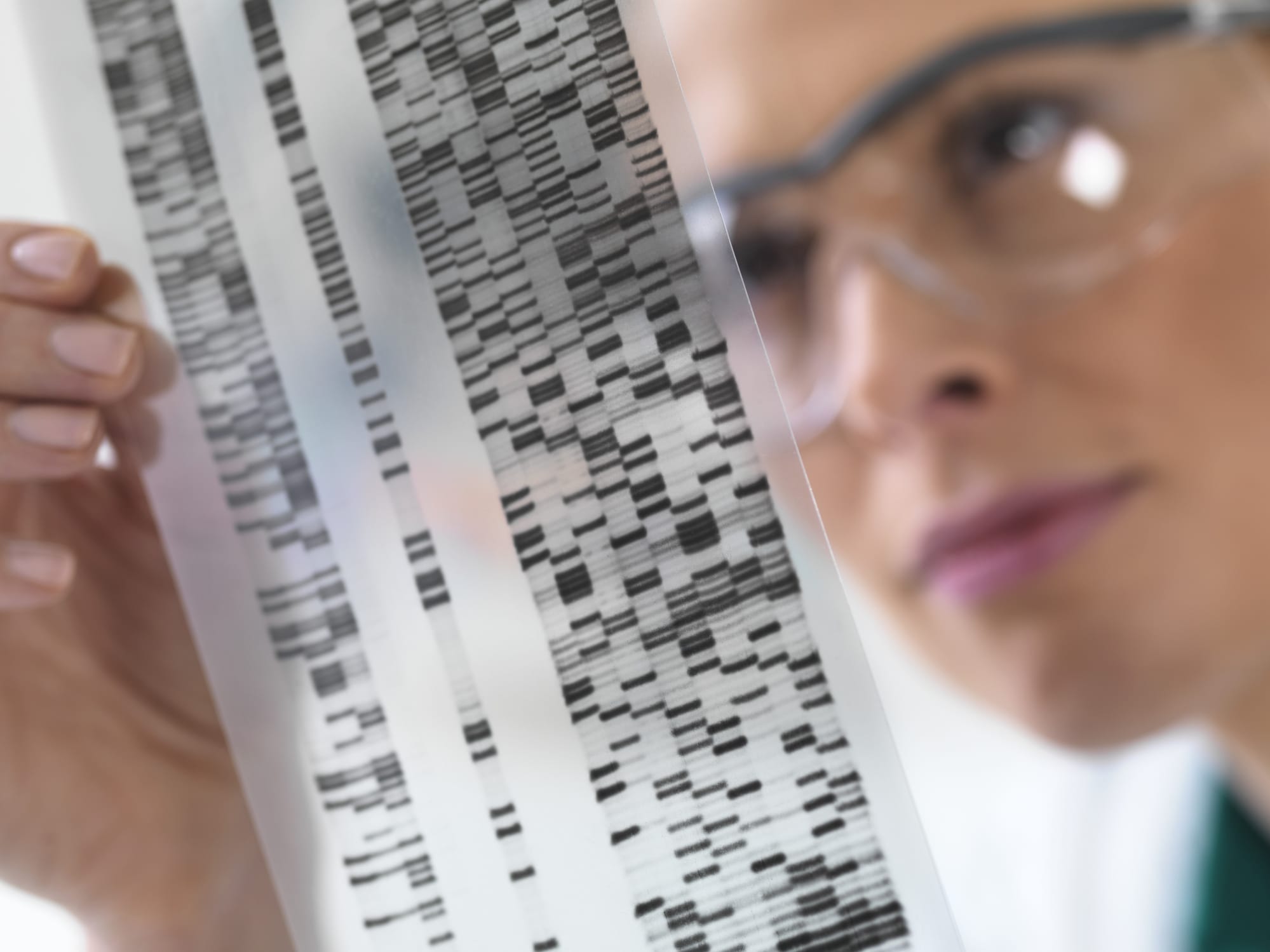 Female scientist looking at a DNA (Deoxyribonucleic acid) autoradiogram