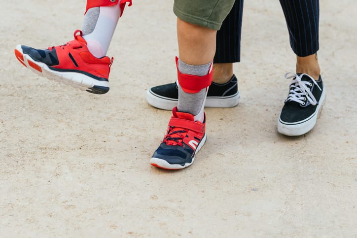 Close-up view of a child's feet with leg splints to help him walk. Behind him is his mother supporting him in the exercises.