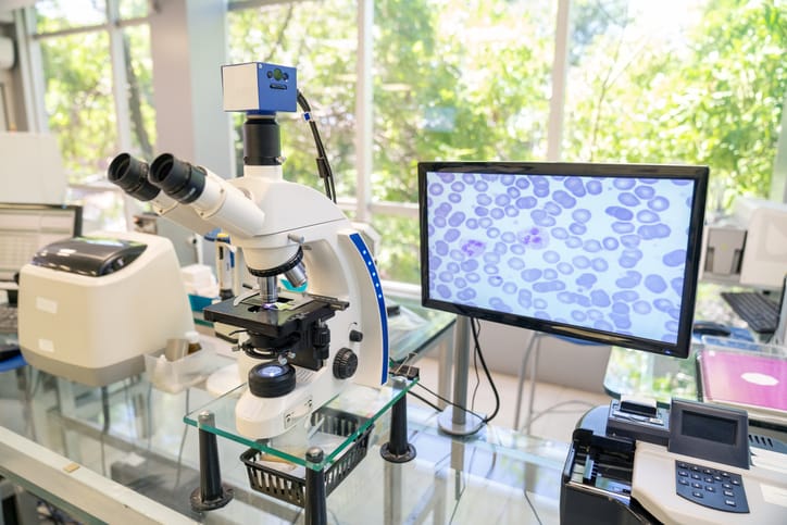 Microscope and screen showing bacteria in a research lab