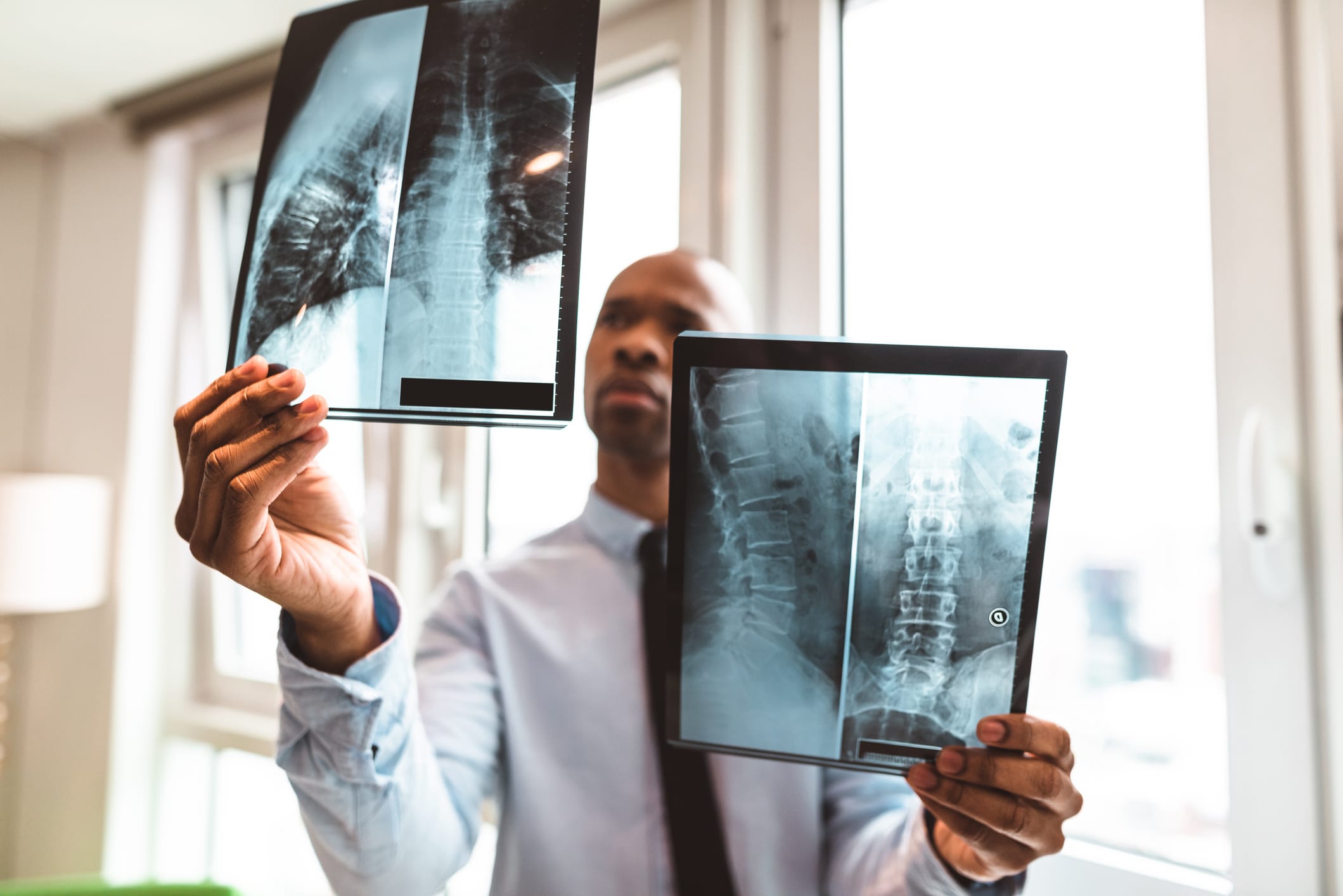 Doctor reading an x-ray in the office