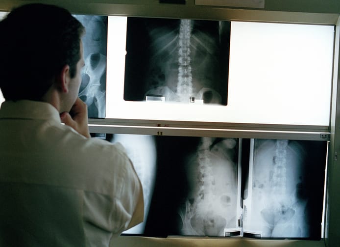 Doctor looking at x-rays on lightboxes