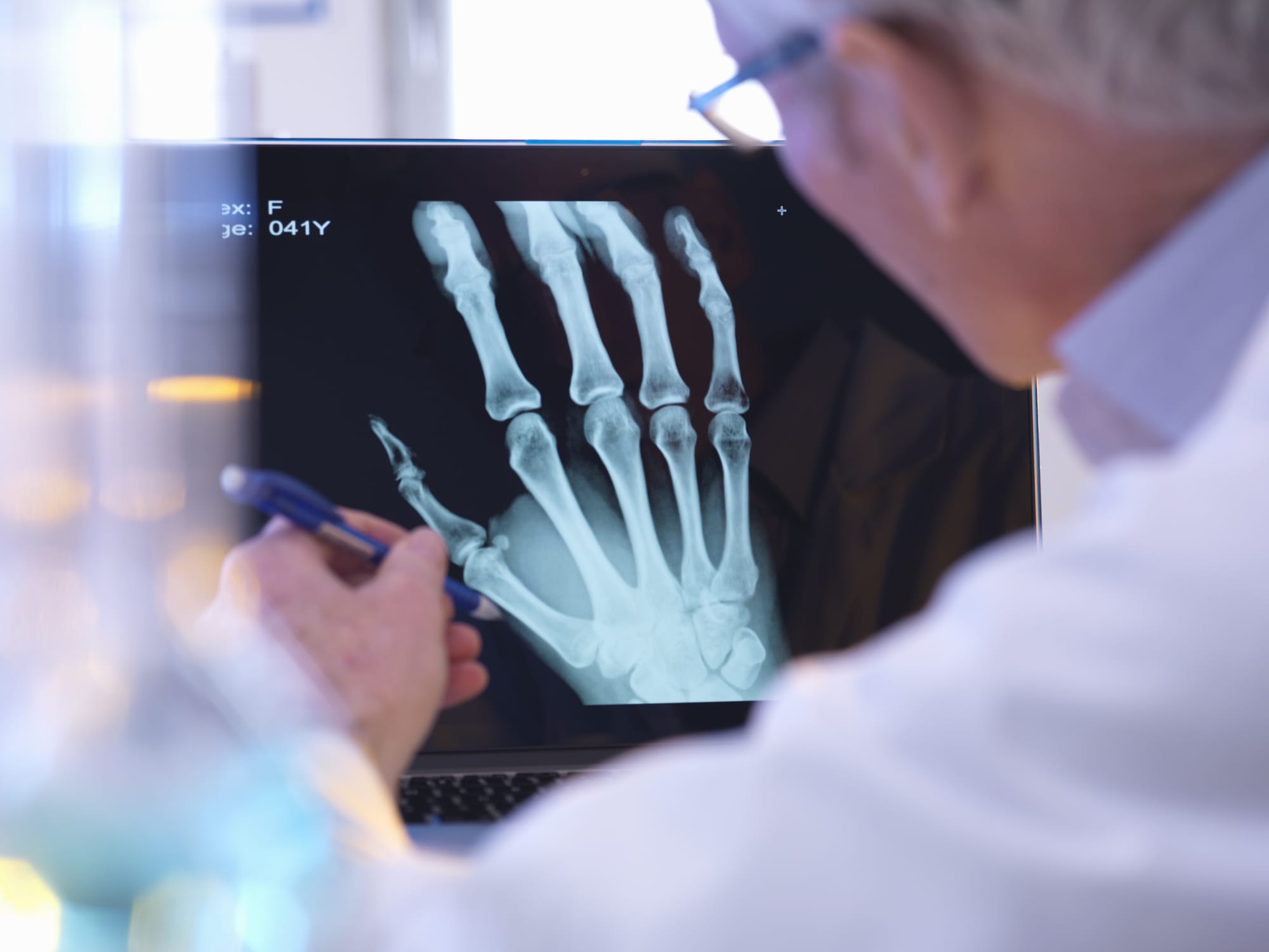Radiographer looking at x-ray of hand